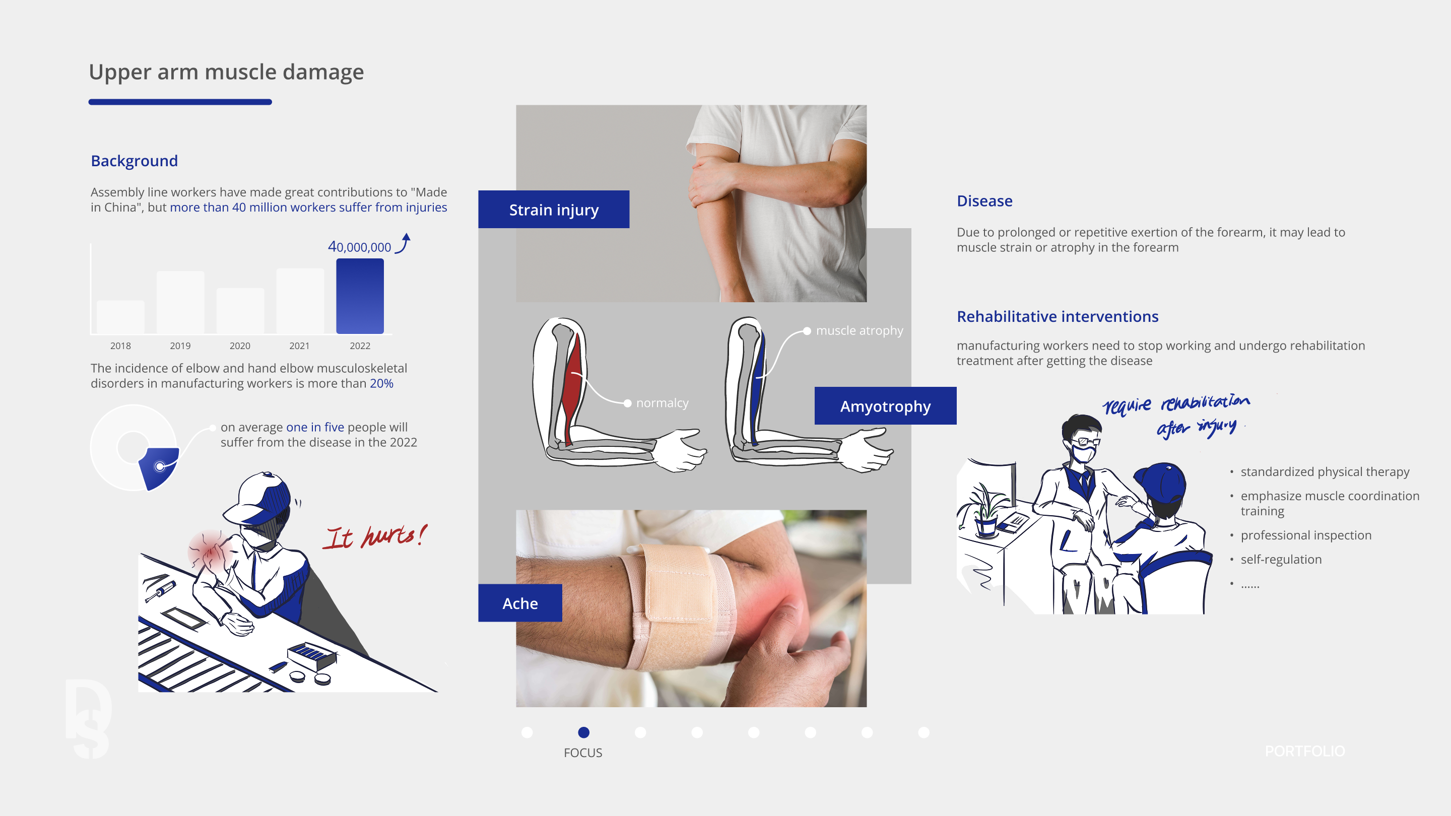 Research board on upper arm muscle damage among assembly line workers, with the 40-million injury figure, rising strain and atrophy statistics, and the over-20% musculoskeletal-disorder incidence.